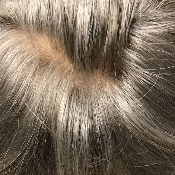 Jazz Mono Top Wig by Rene’ of Paris - Picture 7 of 8